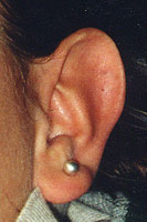Ear Piercing Variations